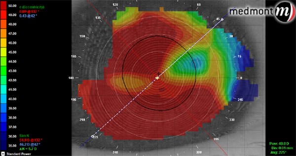 Medmont Topography