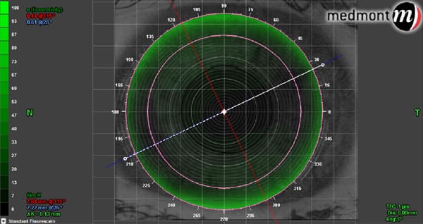 Medmont Topography