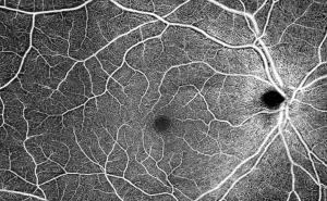 Angiography normal 2019