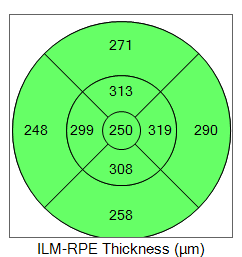 OCT macular scan normal 2019 height map